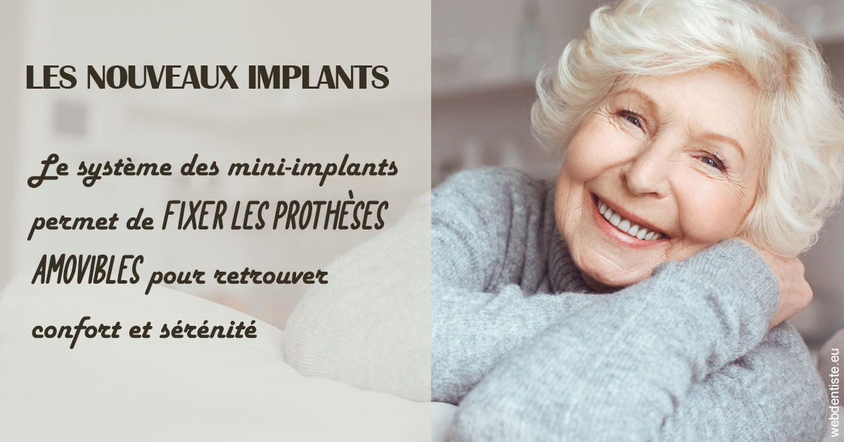 https://dr-petrakian-jean-marc.chirurgiens-dentistes.fr/Les nouveaux implants 1