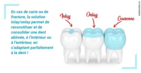 https://dr-petrakian-jean-marc.chirurgiens-dentistes.fr/L'INLAY ou l'ONLAY
