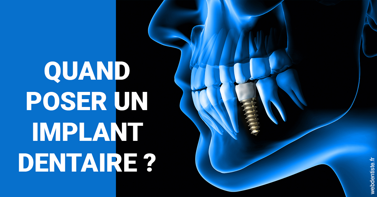 https://dr-petrakian-jean-marc.chirurgiens-dentistes.fr/Les implants 1