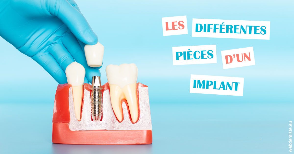 https://dr-petrakian-jean-marc.chirurgiens-dentistes.fr/Les différentes pièces d’un implant 2