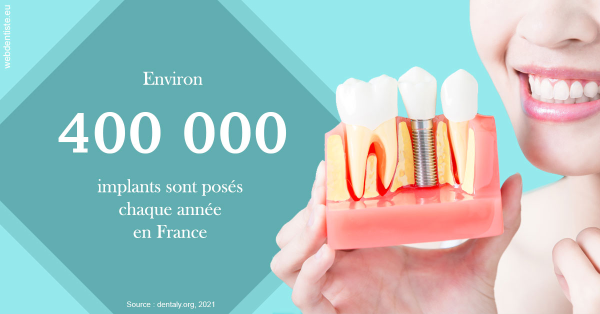 https://dr-petrakian-jean-marc.chirurgiens-dentistes.fr/Pose d'implants en France 2